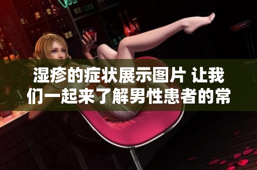 湿疹的症状展示图片 让我们一起来了解男性患者的常见表现